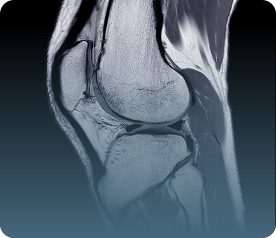 MRI Magnetic Resonance Imaging